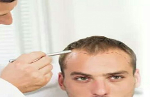 Derman Hair Transplant